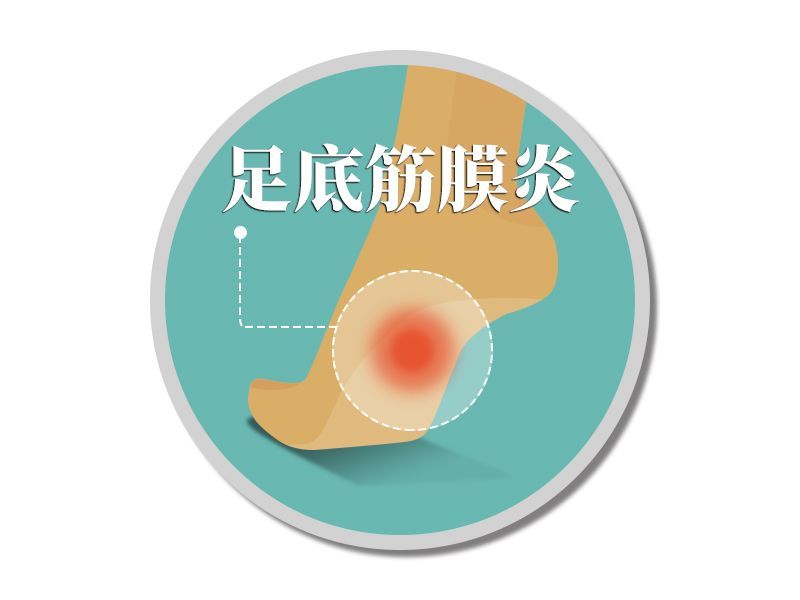 是过度足内翻以及鞋子过度磨损;突然增加山地,速度练习,或前脚掌跑步