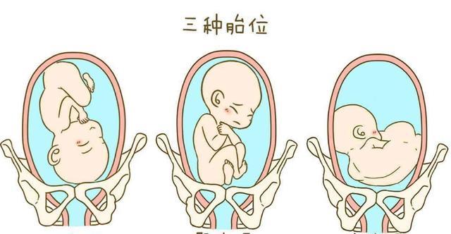 孕期,怎样看懂胎位数据,早了解,早纠正