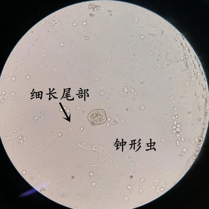 一如往常忙碌的上午,当自己在镜检某尿液标本沉渣时,发现视野中出现