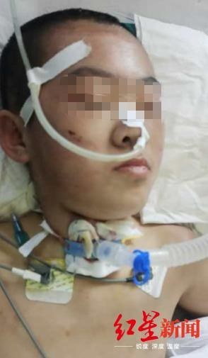 残忍！12岁女儿遭继母虐打，脑梗死住进ICU，生父差点晕倒