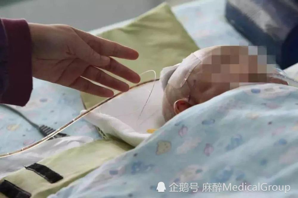 “想躲，却来不及了”，其中的科学道理