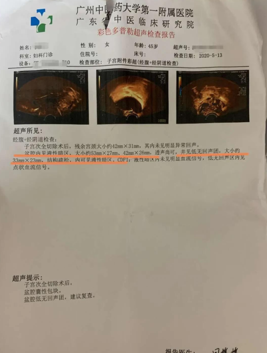 给子宫内膜异位症的朋友两点贴心建议