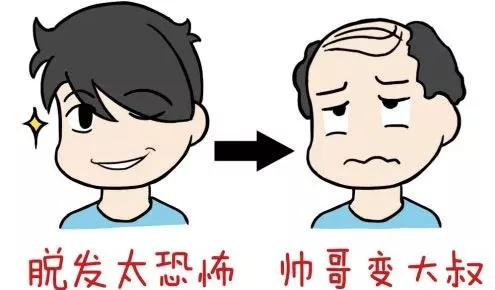 欧婷儿:"秃"如其来,我该拿什么拯救你,我的发际线?