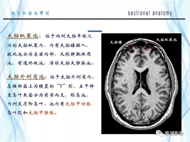 超全详解:脑池和脑室断层解剖