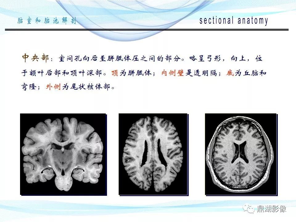 超全详解:脑池和脑室断层解剖