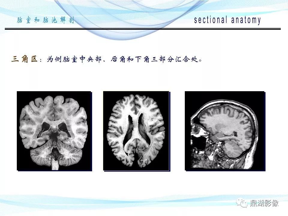 超全详解:脑池和脑室断层解剖