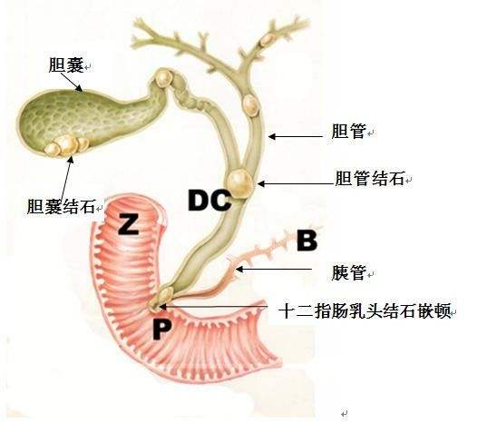 顺着这两条管道在十二指肠壶腹处(位置p,也是oddi括约肌所在处)同食物