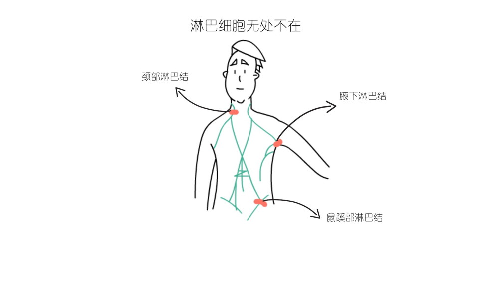 目前淋巴瘤的主要治疗方式有化疗和放疗,但由于人体内的淋巴细胞无处