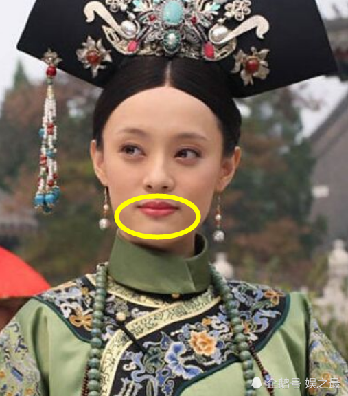 孙俪下巴的痣在慢慢长大被吐槽影响颜值她本人给出不去掉的原因