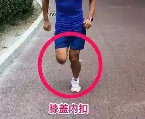 求助！跑步膝盖疼痛该怎么办？