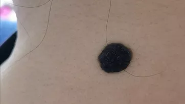 1000