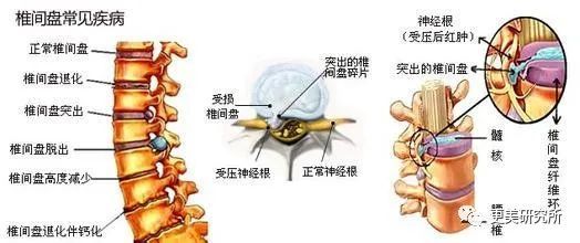 杨紫腰上的肉溢出屏幕，而赵丽颖刚生完娃还能瘦成腰精？