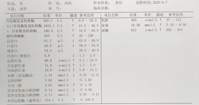 56岁患肝癌，从发病到死亡仅半个月，医生：不要等到出现右上腹痛才来看肝脏