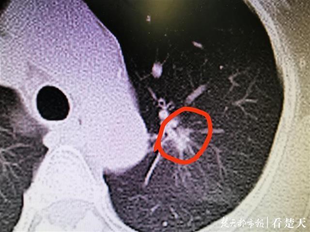 梦见被蛇咬右手，潜意识中的警示与转变象征
