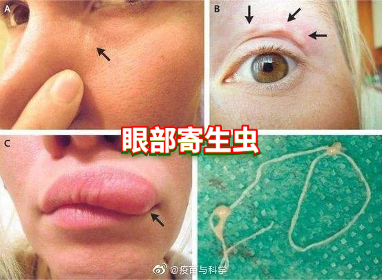三文鱼出事了，你还敢吃么？那么醉虾呢？