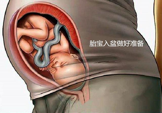 胎儿"入盆"后,准妈妈身体会有4种变化,你占了几条?