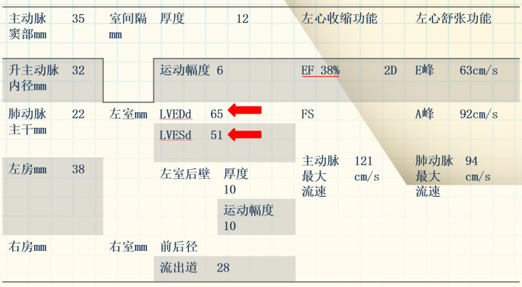 患者入院心电图 ▎心脏超声: 节段性室壁运动异常,左心增大,室