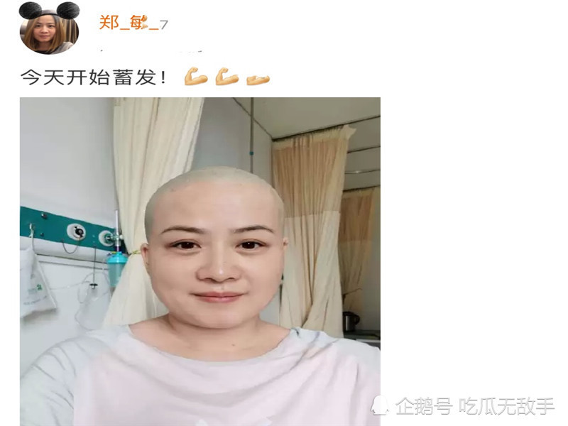 担心!岳云鹏妻子郑敏生病剃光头,节目中回忆被观众轰下台的经历