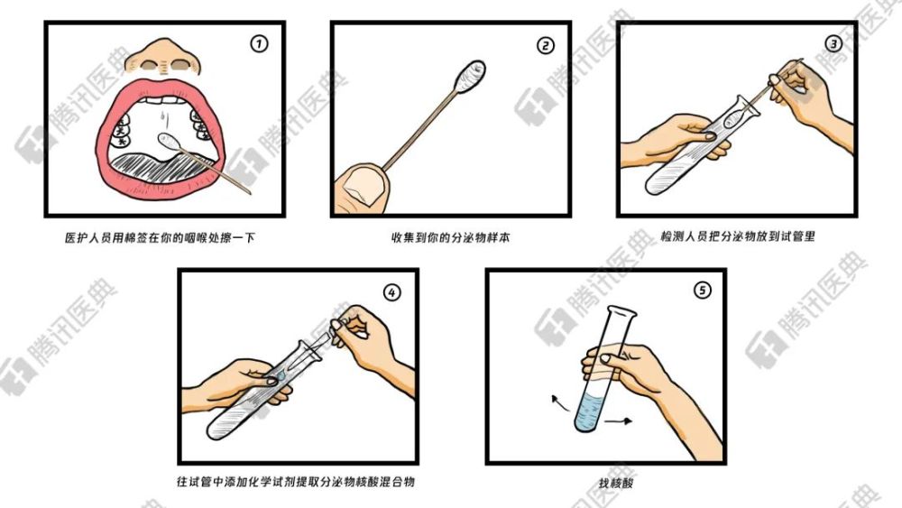 为什么新冠核酸阳性和无症状感染,不等于确诊?原来差别在这里!