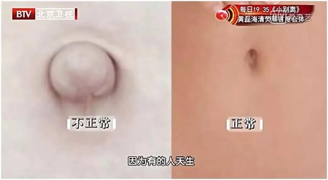 我国慢性肝病患者可能超4亿！比熬夜更伤肝的事，很多人还天天在做