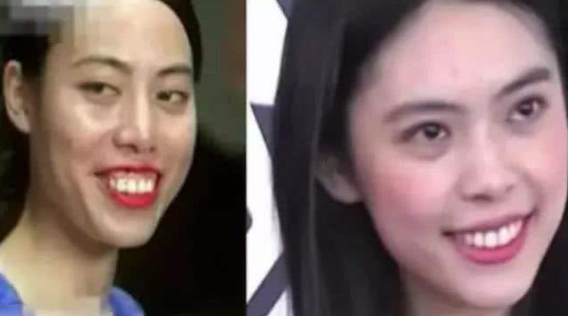 取下龅牙后美到认不出,翻版王祖贤