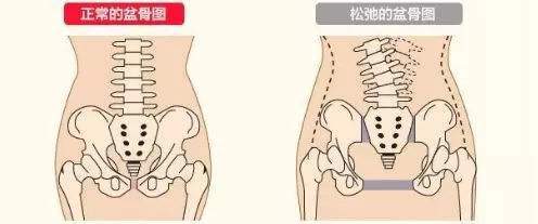 孕晚期最难熬的"耻骨痛",5类孕妈要注意,千万别被找上门