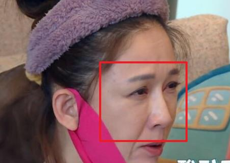 陈乔恩素颜勒瘦脸绷带,当镜头拉近十倍,她今年41岁了吗?