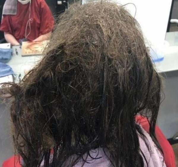 坚持一年不洗头会怎样?看看这位的头发,网友:头皮发麻!