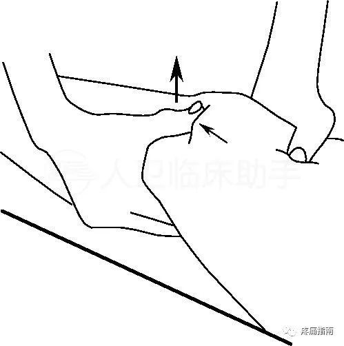 俯卧位lachman试验特别适用于患者大腿粗壮难以握持时,患者俯卧,检查