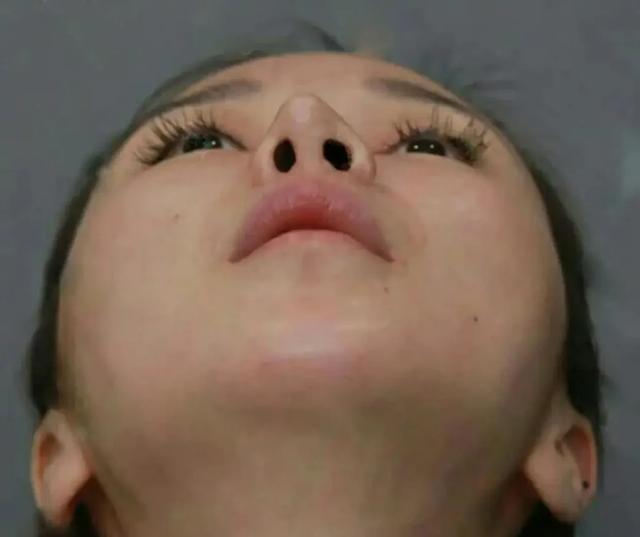 公认的5种"丑鼻型,一鼻毁了整张脸,颜值再高也拯救不了