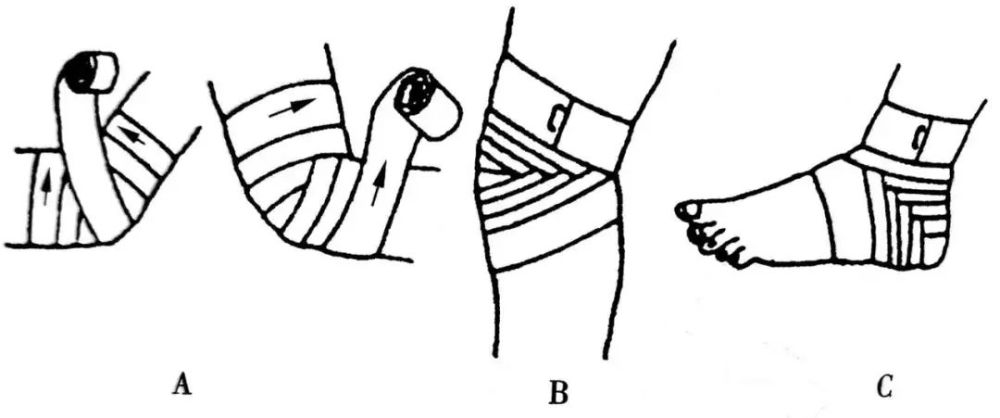 伤口包扎法关键时刻肯定用的上