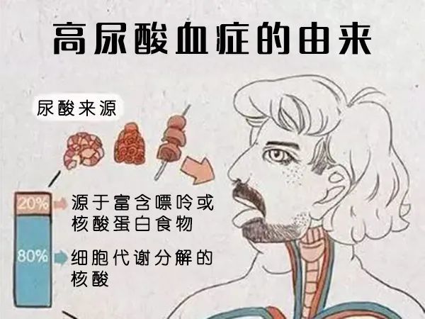 无症状高尿酸血症需要治疗吗