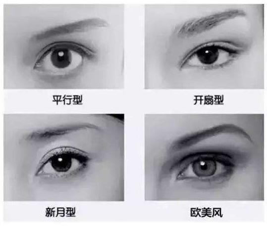 双眼皮手术难吗?说出来你可能不信