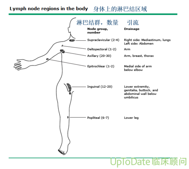 一文看懂:淋巴结变大是肿瘤转移了吗?淋巴水肿了怎么