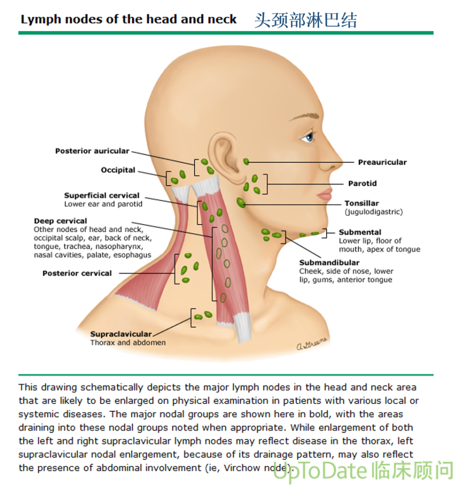 一文看懂:淋巴结变大是肿瘤转移了吗?淋巴水肿了怎么办?