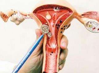 重庆弘医堂妇科医院分享:卵巢囊肿有哪些治疗方法