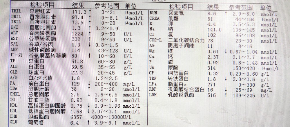 成人黄疸大约可以分为三种类型,溶血性黄疸:产生过多;肝细胞性