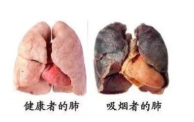 吸烟仅仅危害肺而已?