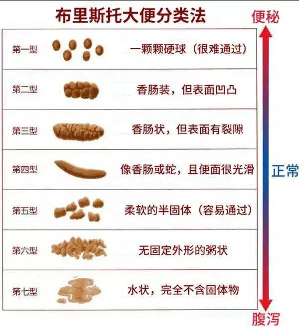 大便颜色可看出身体状况?看看你的是哪种颜色