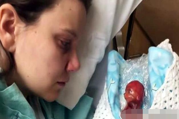 在美国的一所医院里,就曾接生过一个"史上最小婴儿,这个小孩在21周
