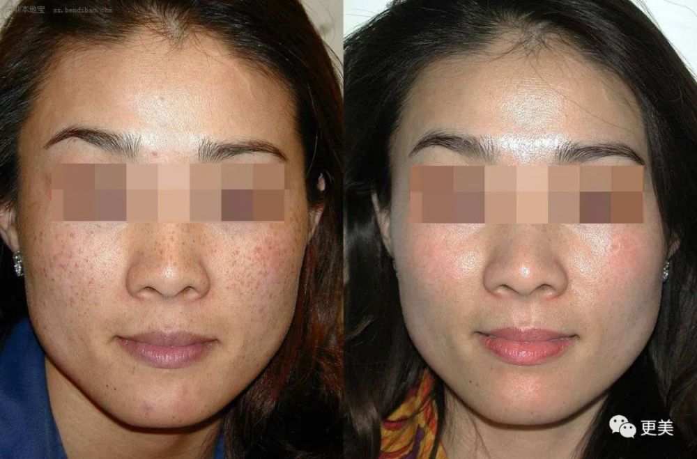 硬炒素颜人设却不敢卸妆，美得吃力的鞠婧祎到底在怕啥？