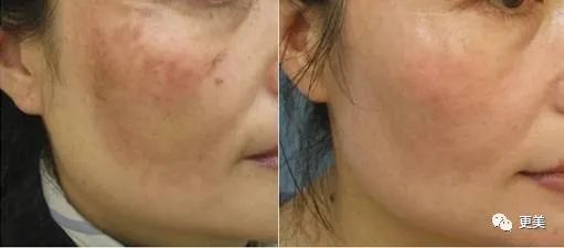硬炒素颜人设却不敢卸妆，美得吃力的鞠婧祎到底在怕啥？