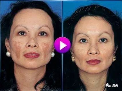 硬炒素颜人设却不敢卸妆，美得吃力的鞠婧祎到底在怕啥？