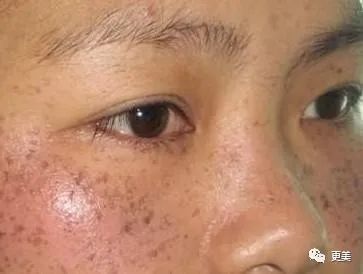 硬炒素颜人设却不敢卸妆，美得吃力的鞠婧祎到底在怕啥？