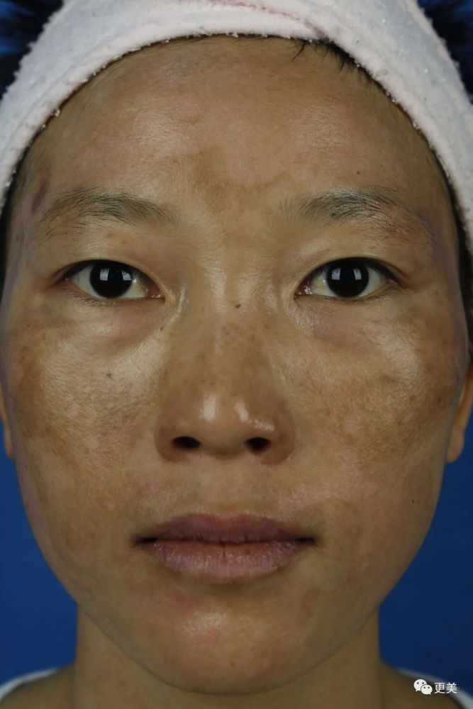 硬炒素颜人设却不敢卸妆，美得吃力的鞠婧祎到底在怕啥？