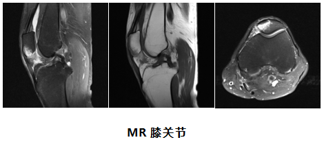 临床医生应该知道的磁共振知识二
