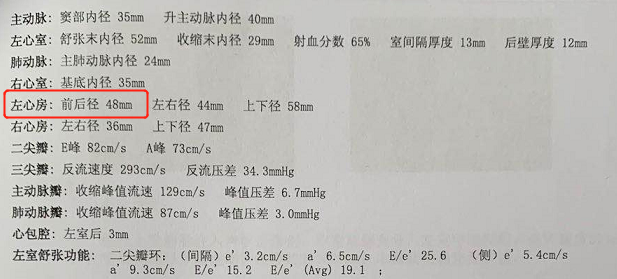 超声心动图上的