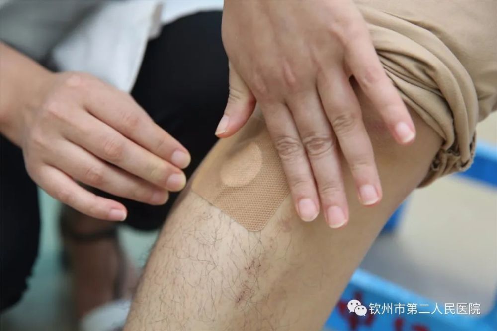 “冬病夏治”――钦州市二医院中医科三伏贴等您来