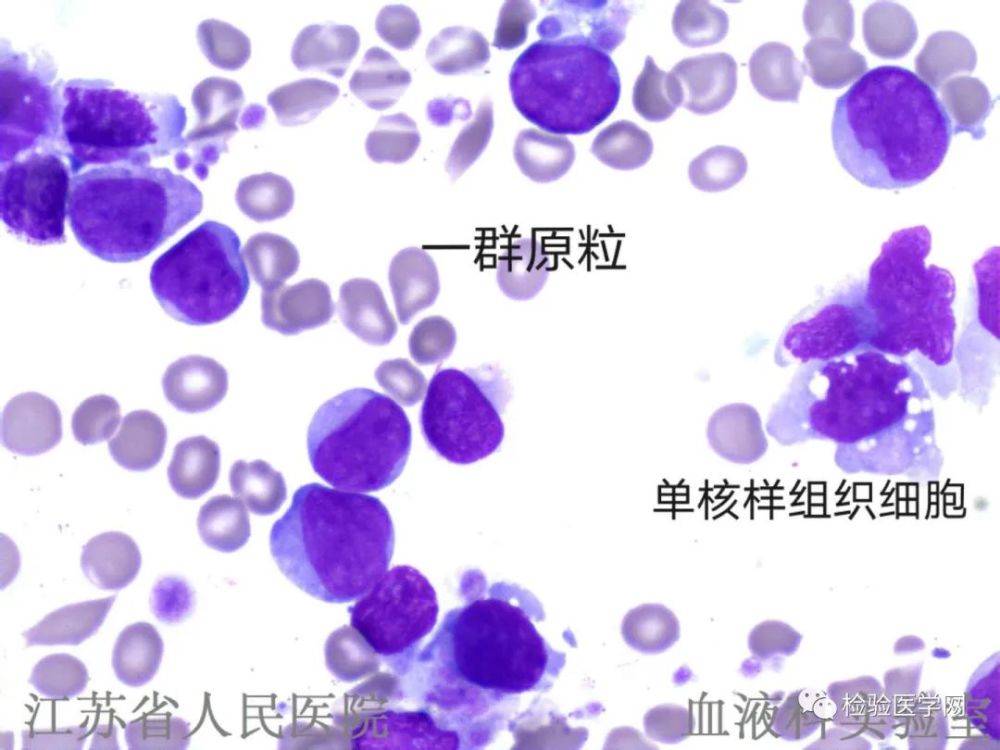 染色图片 左右 01 杯口(cup like nucleicell)细胞定义