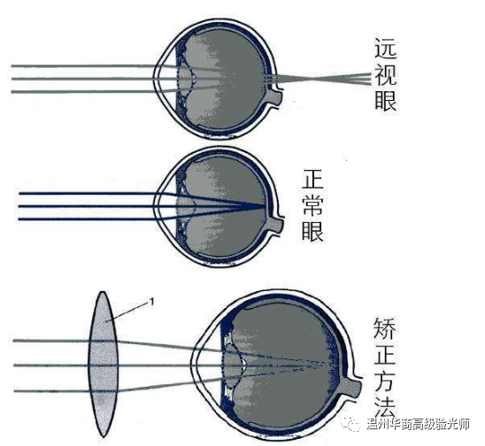 老视与远视的区别?